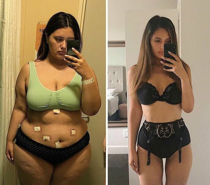 KETO Complete capsule before and after weight loss girl